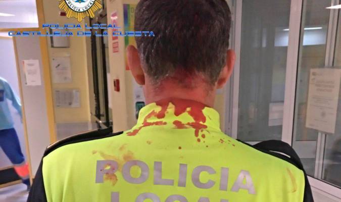 Herido un policía de Castilleja tras intervenir en una reyerta