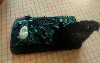 Un joven sufre quemaduras graves tras explotar su móvil mientras dormía