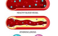 Tipos de colesterol /Freepik.es