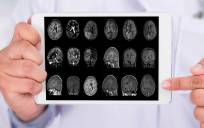 Un nuevo estudio sobre el Alzheimer revela su causa, distinta de la que se pensaba 