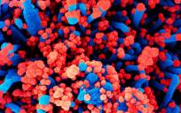 Imagen cedida por el CSIC de una micrografía electrónica de barrido de células humanas (azul) infectadas con SARS-CoV-2 (rojo)./NIH. EFE