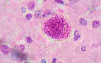 Descubren la increíble propagación del parásito Toxoplasma entre los humanos