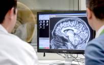 Médicos miran el cerebro de un paciente. / E.P.