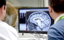 Las infecciones hospitalarias elevan el riesgo de Alzheimer y Parkinson