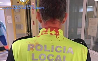 Herido un policía de Castilleja tras intervenir en una reyerta