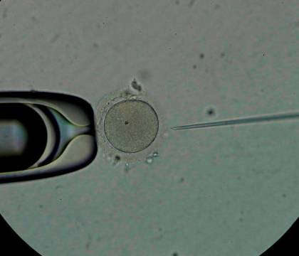 Investigan nuevos resultados en la fecundación in vitro