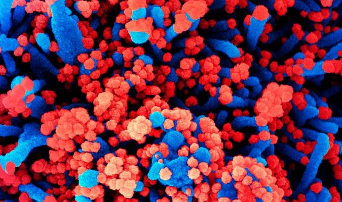 Imagen cedida por el CSIC de una micrografía electrónica de barrido de células humanas (azul) infectadas con SARS-CoV-2 (rojo)./NIH. EFE