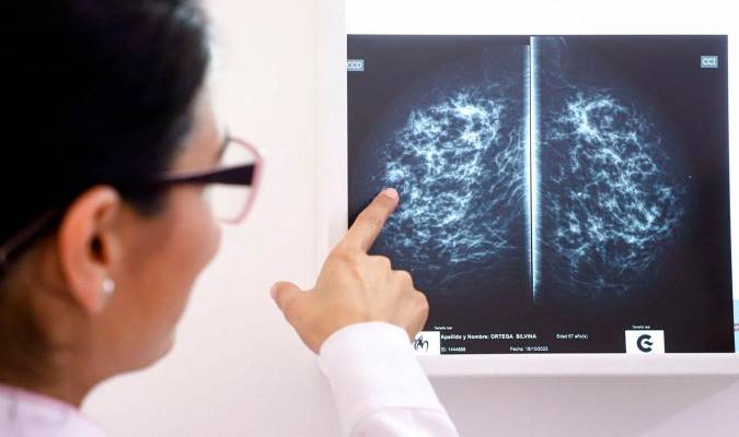 Una médico observando una radiografía. / EFE