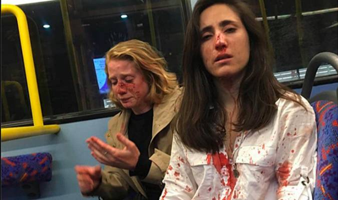 Melania Geymonat y su novia, tras la agresión que sufrieron en un autobús de Londres el 30 de mayo.