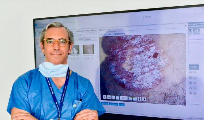 David Moreno Ramírez, en la sala digital del Servicio de Dermatología del Hospital Macarena. / EL CORREO