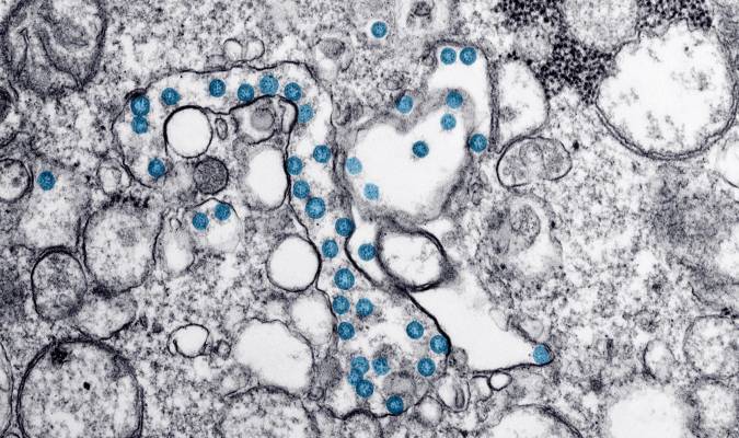 Un estudio apunta que el coronavirus inflige daños al cerebro