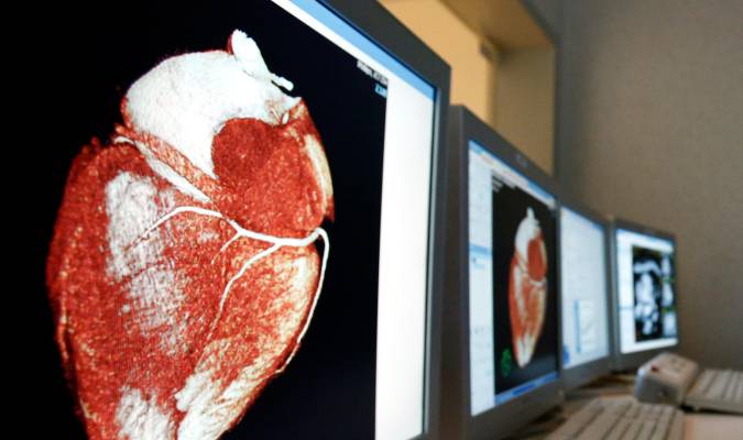 Salud promueve la reanimación cardíaca: «Si no haces nada, es un muerto»