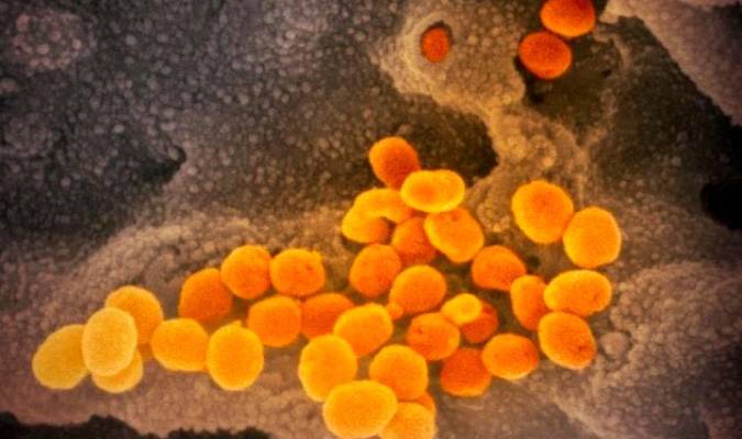 Esta imagen de microscopio electrónico de barrido muestra el SARS-CoV-2 (naranja), el virus que causa la COVID-19, aislado de un paciente en EE.UU. El virus emerge de la superficie de las células (gris) cultivadas en el laboratorio.