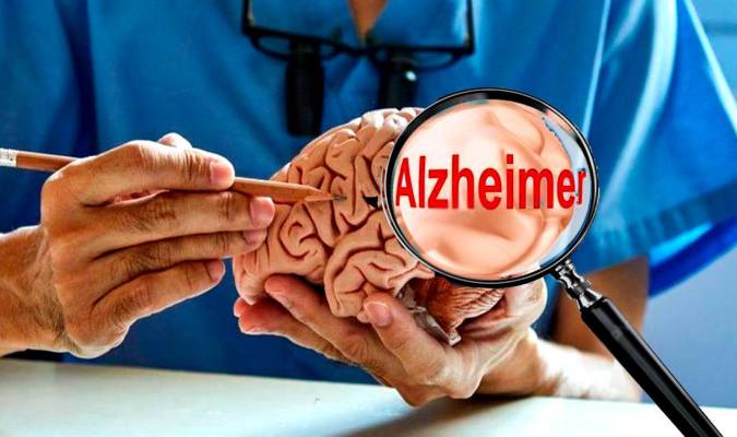 Más cerca de lograr una cura para el Alzheimer