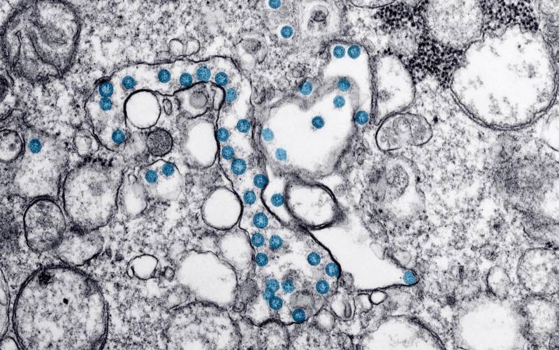 Un estudio apunta que el coronavirus inflige daños al cerebro