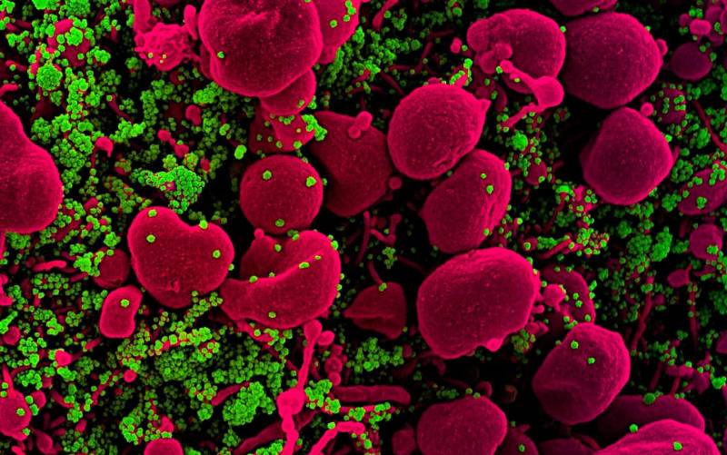 Micrografía electrónica de barrido coloreada de una célula apoptótica (rosa) muy infectada con partículas del virus SARS-COV-2 (verde).