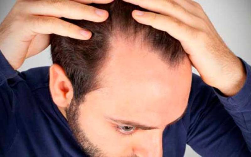 Advierten de un alarmante incremento de la caída del cabello en el confinamiento