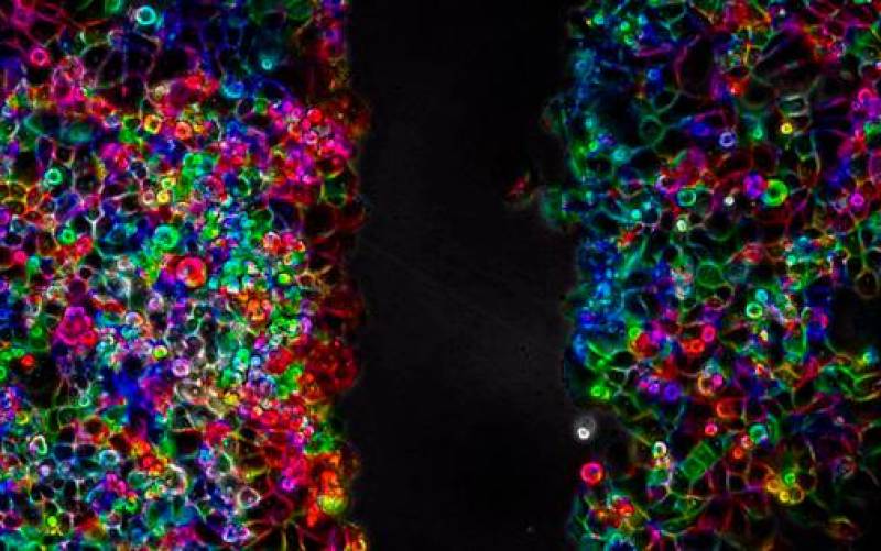 Células de cáncer de páncreas durante un proceso de migración celular. Imagen cedida por el Instituto de Tecnologías Físicas y de la Información Leonardo Torres Quevedo (ITEFI) del Consejo Superior de Investigaciones Científicas. EFE