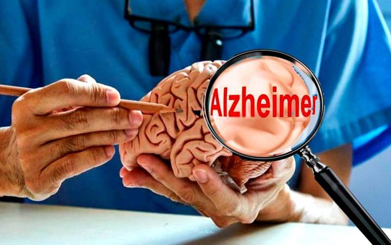 Más cerca de lograr una cura para el Alzheimer